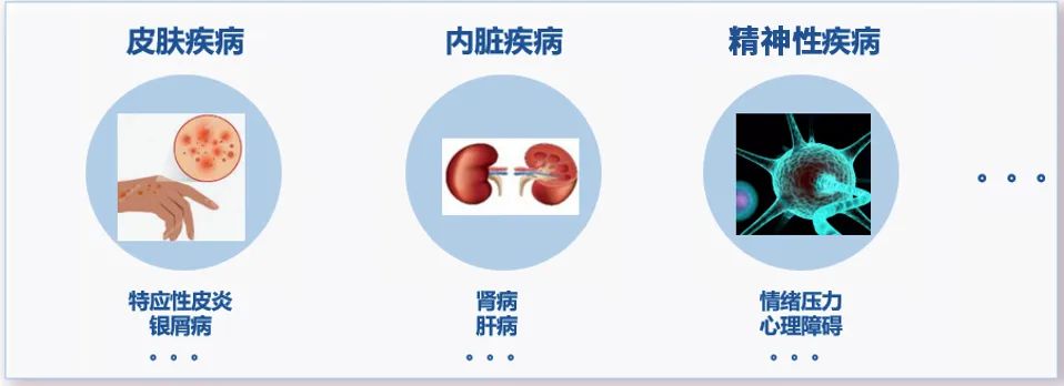 慢性瘙痒性疾病中“瘙痒之最” —— 结节性痒疹