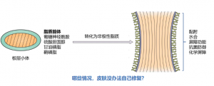 皮肤屏障受损后，不处理，会自愈吗？