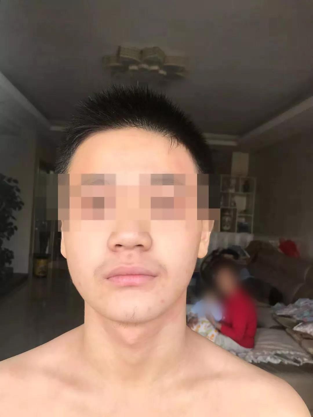 患者故事|AD学生日记