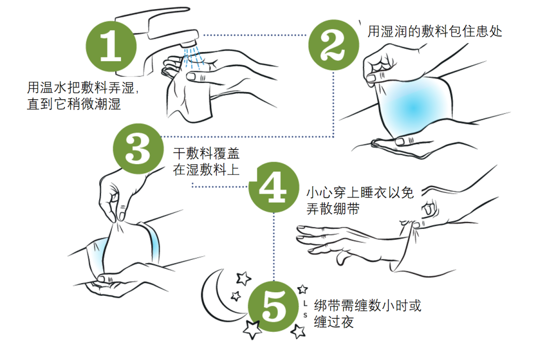 解惑AD | AD的治疗