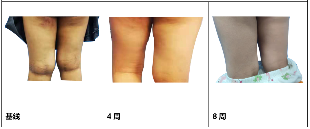 患者故事|踏上旅途,只为寻找希望