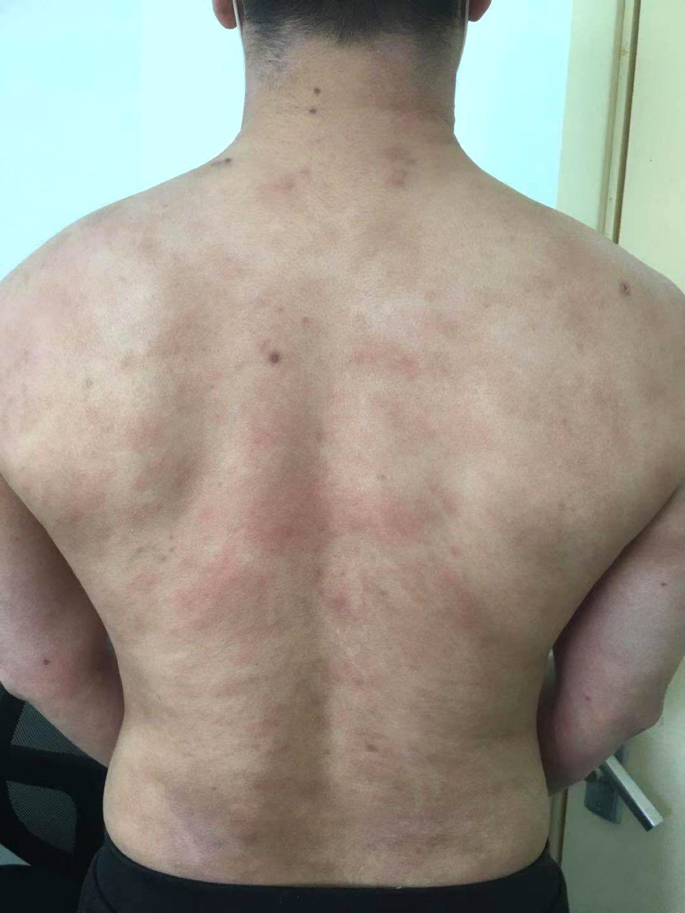 患者故事｜逃离深圳的北京人