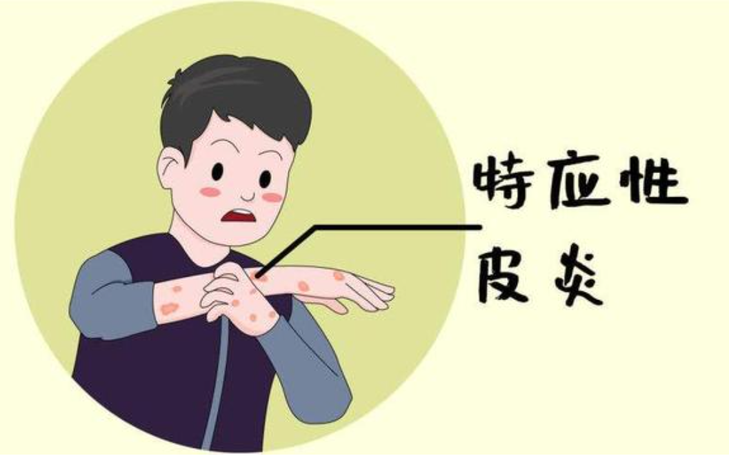 一文了解:如何安全有效的长期管理特应性皮炎