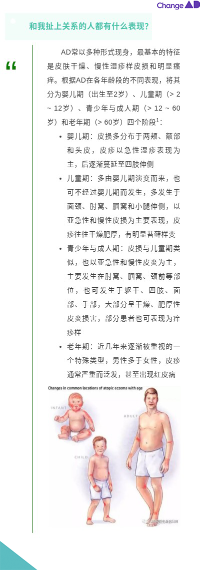 认识AD、了解AD,我们一直都在改变