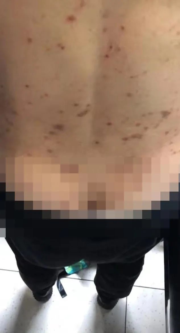 患者故事|让我内疚、让我心疼的AD母亲