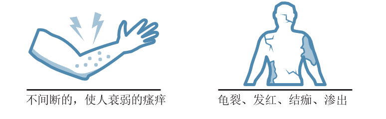 解惑AD｜特应性皮炎概况一览