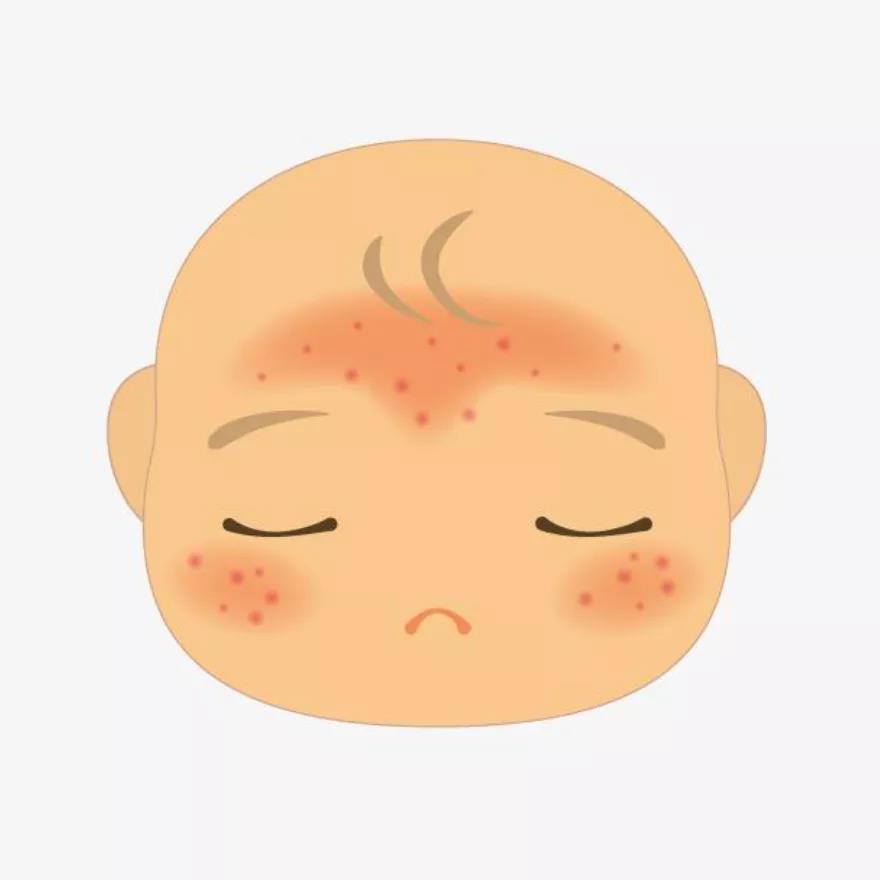 患者故事|一位医生与特应性皮炎的斗争史