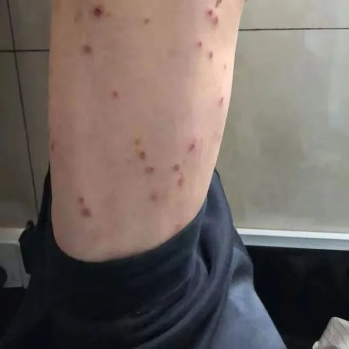 患者故事|让我内疚、让我心疼的AD母亲