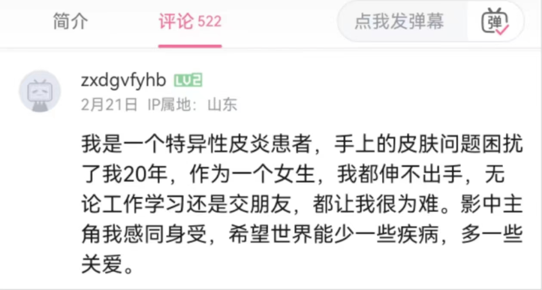 AD姊妹病：银屑病公益大电影《你好，我的银色恋人》值得一看！