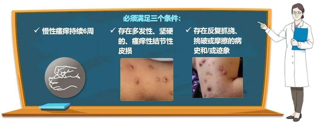 慢性瘙痒性疾病中“瘙痒之最” —— 结节性痒疹