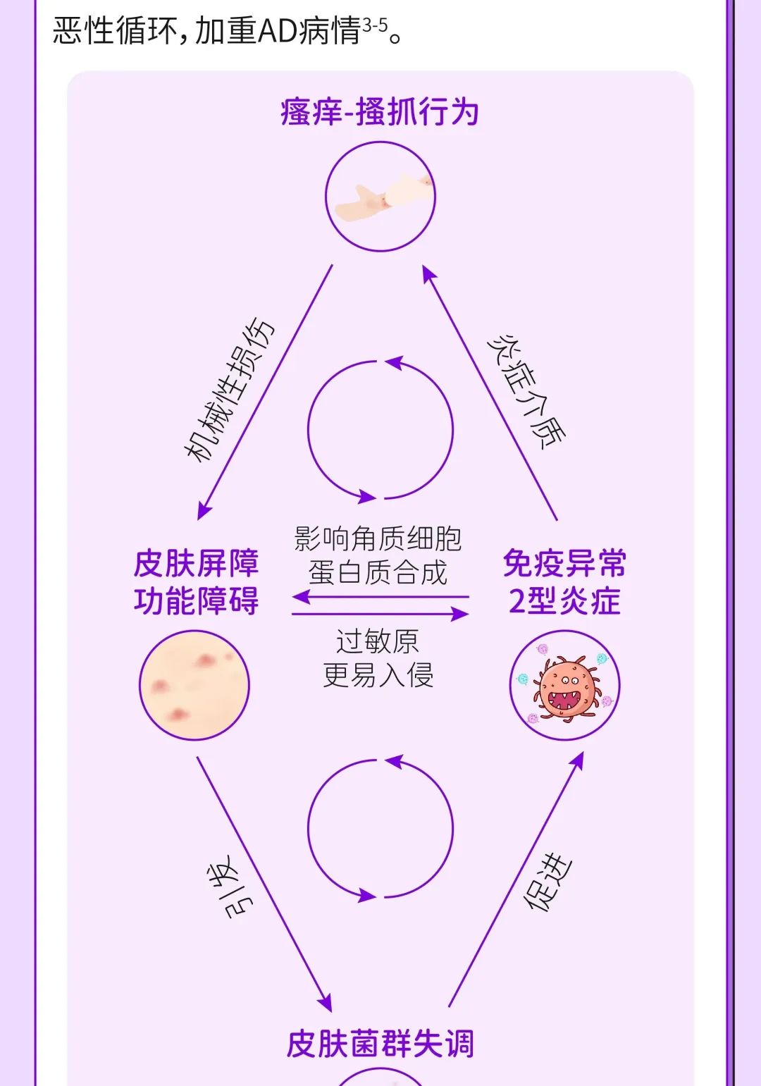 真心求问：特应性皮炎真的会跟我一辈子吗？