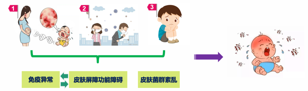 告别“小特”,拒绝“大特”,特应性皮炎治疗新攻略