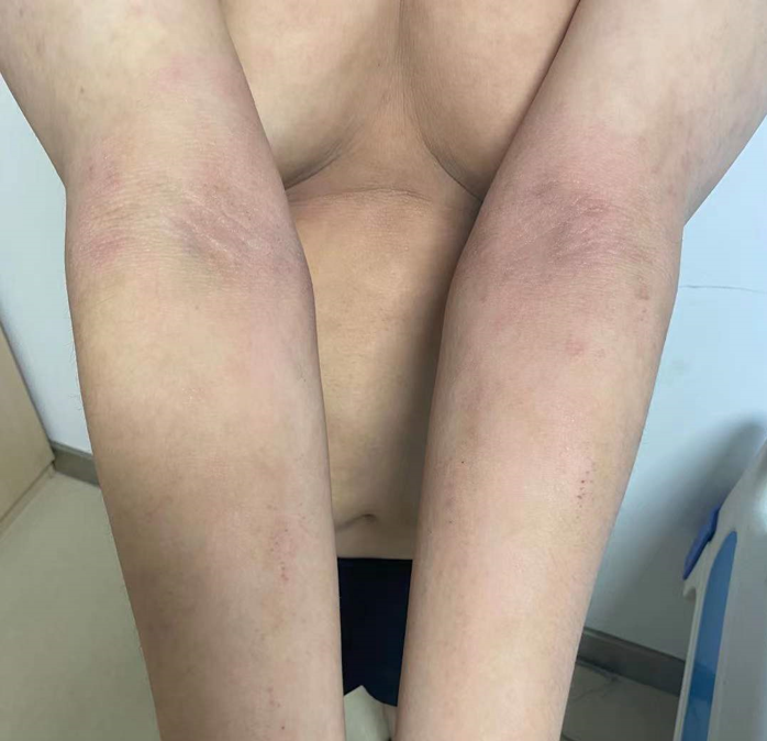 患者故事|AD家庭的凌晨四点