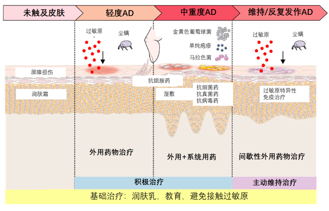 解惑AD | AD的治疗