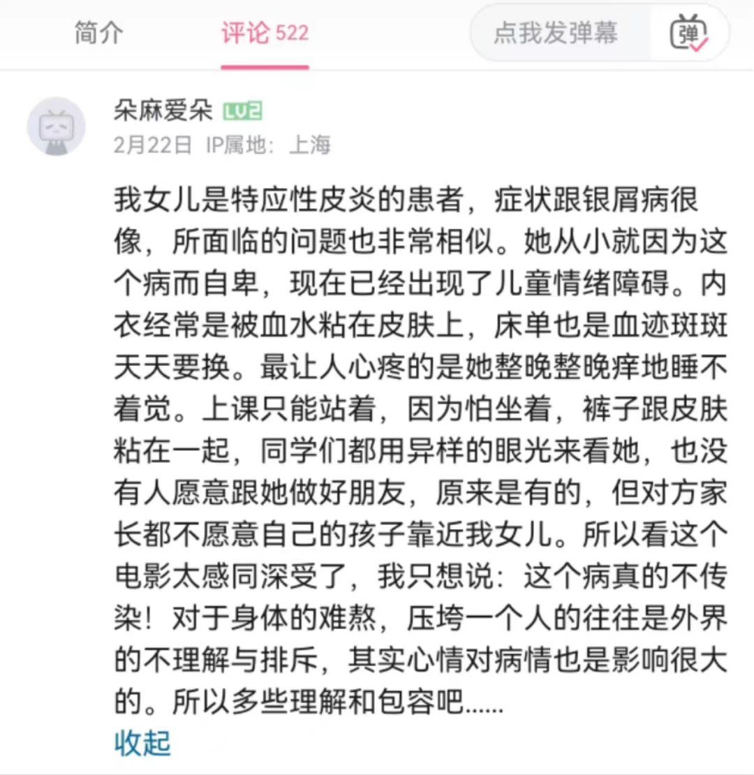 AD姊妹病：银屑病公益大电影《你好，我的银色恋人》值得一看！