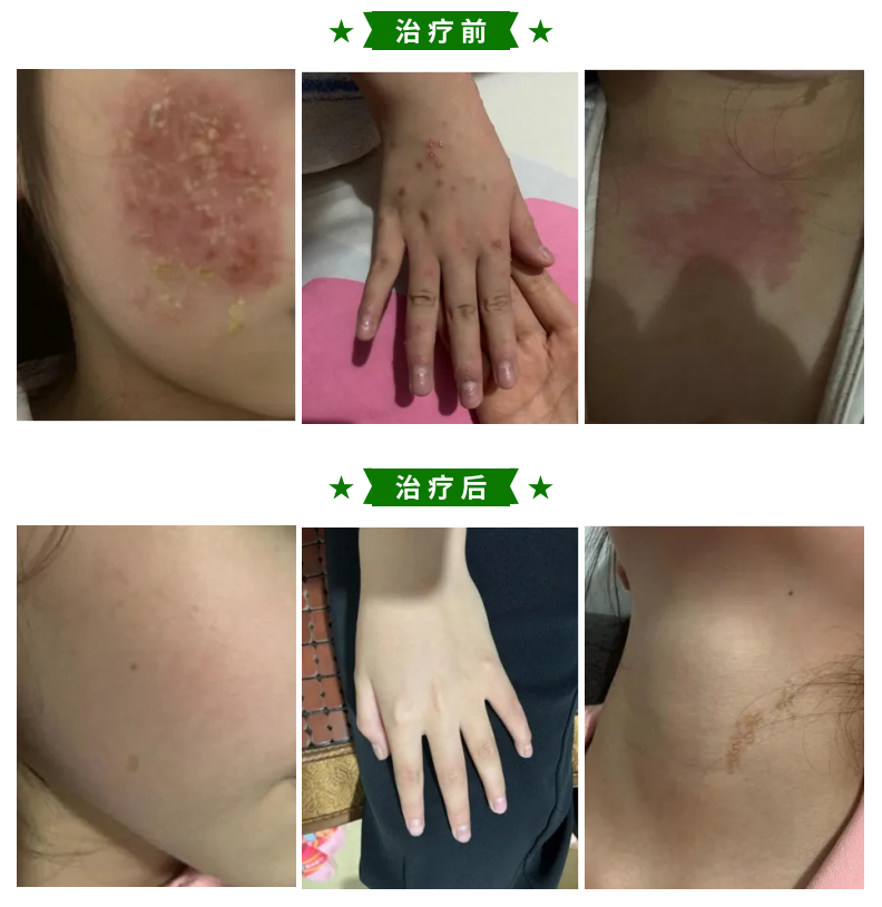 患者故事｜一个家庭的故事，一颗希望的种子